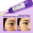 SOME BY MI Retinol Intense Advanced Triple Action Eye Cream – Anti-Wrinkle & Brightening